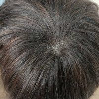 کلاه گیس مردانه طبیعی پروتز مو بالای سر مردانه (کد:8025)