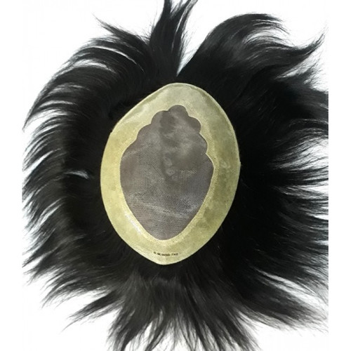 پروتز لس آنجلسی