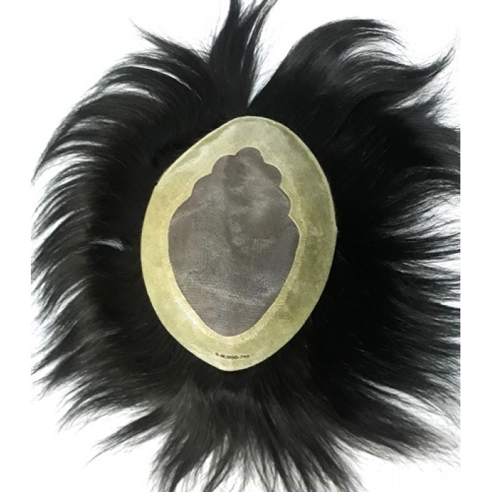 پروتز لس آنجلسی