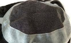 پروتز لس آنجلسی