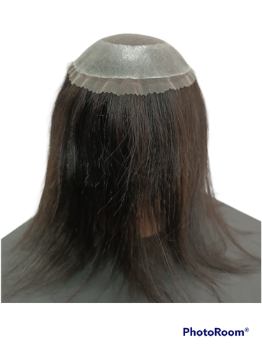 پروتز مو مردانه