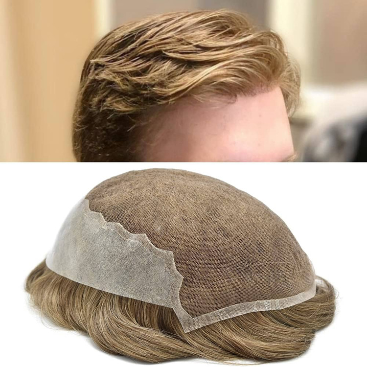 پروتز مو مردانه