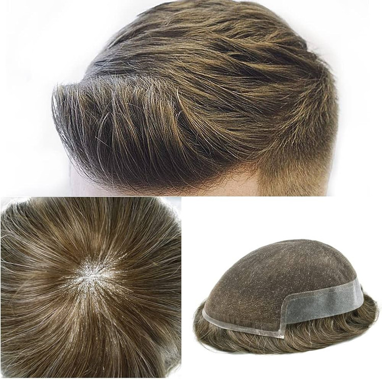 پروتز مو عمده