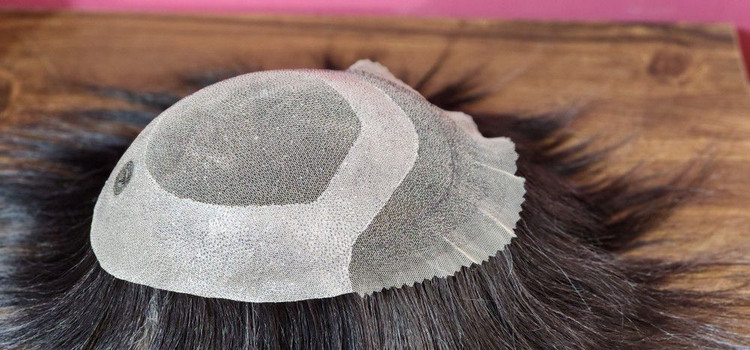 پروتز آنکارایی