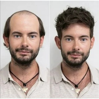 کلاه گیس مردانه