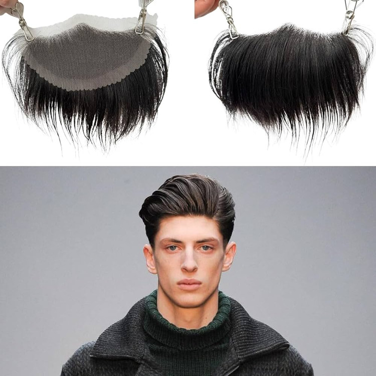 پروتز جلو سر مردانه